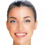 Beauty Tips: ఎండకు చర్మం నల్లబడిందా… అరటి పండు మాస్క్ తో ట్యాన్ కు చెక్ పెట్టండి?
