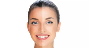 Beauty Tips: ఎండకు చర్మం నల్లబడిందా… అరటి పండు మాస్క్ తో ట్యాన్ కు చెక్ పెట్టండి?